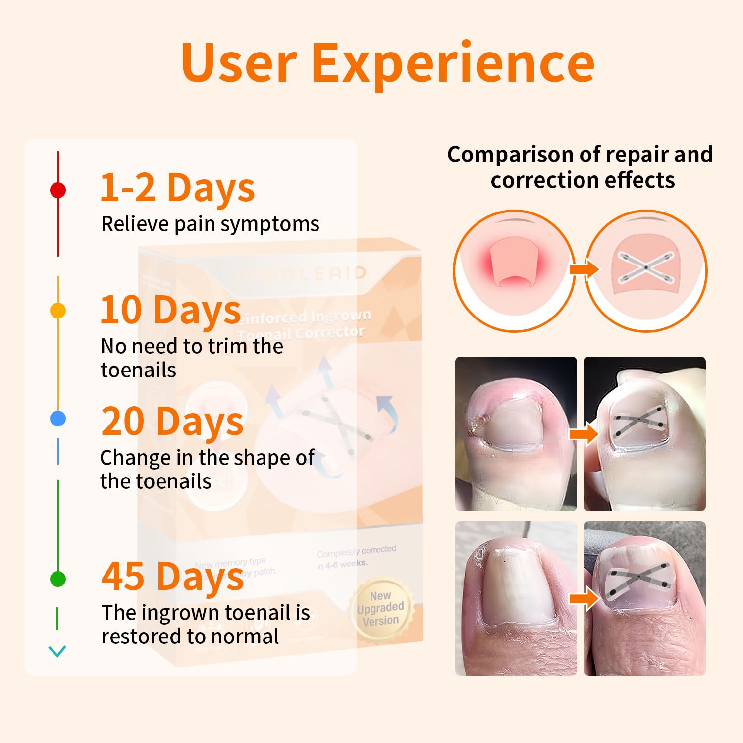 10 Patchs X-Shaped Upgrade Titanium Alloy Ingrown Toenail Corrector,At Home Ingrown Toenail Treatment for Man and Women,Ingrown Toenail Removal Kit,Curved Toenail Corrector (Large Size)