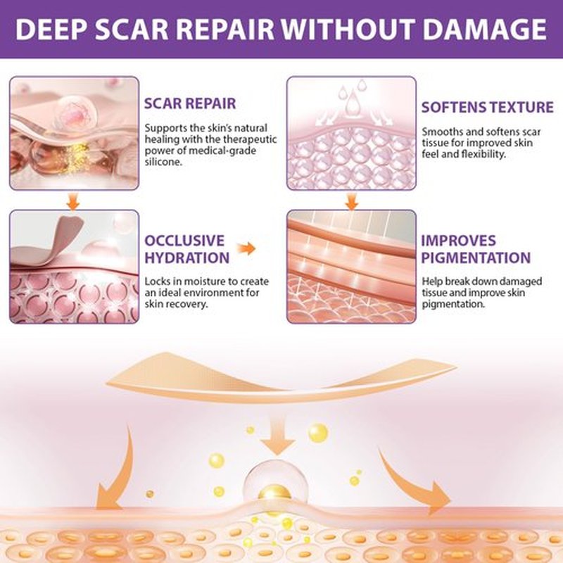 Silicone Scar Sheets, Silicone Sheets for Scars, Silicone Scar Tape for Surgical Scars, Medical Grade Scar Tape for Acne Scar Treatment, Stretch Marks, Tummy Tuck (1.6”x 60”), Roll-1.5M