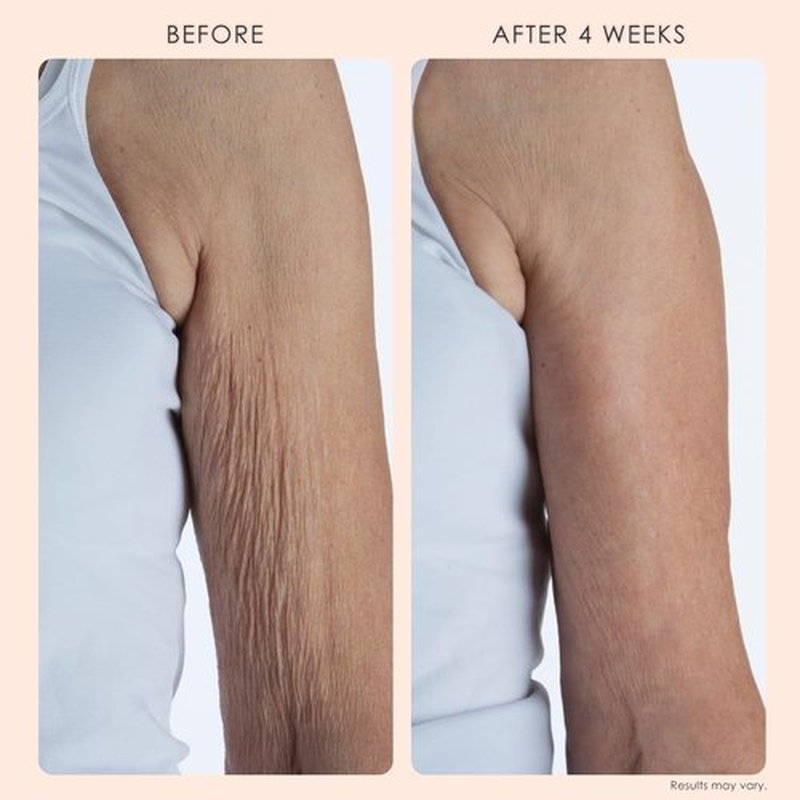 Crepe Erase BODY FIRM 2-Step Anti-Aging Treatment - Firming Moisturizer & Exfoliating Pre-Treatment for Wrinkle & Crepe Skin