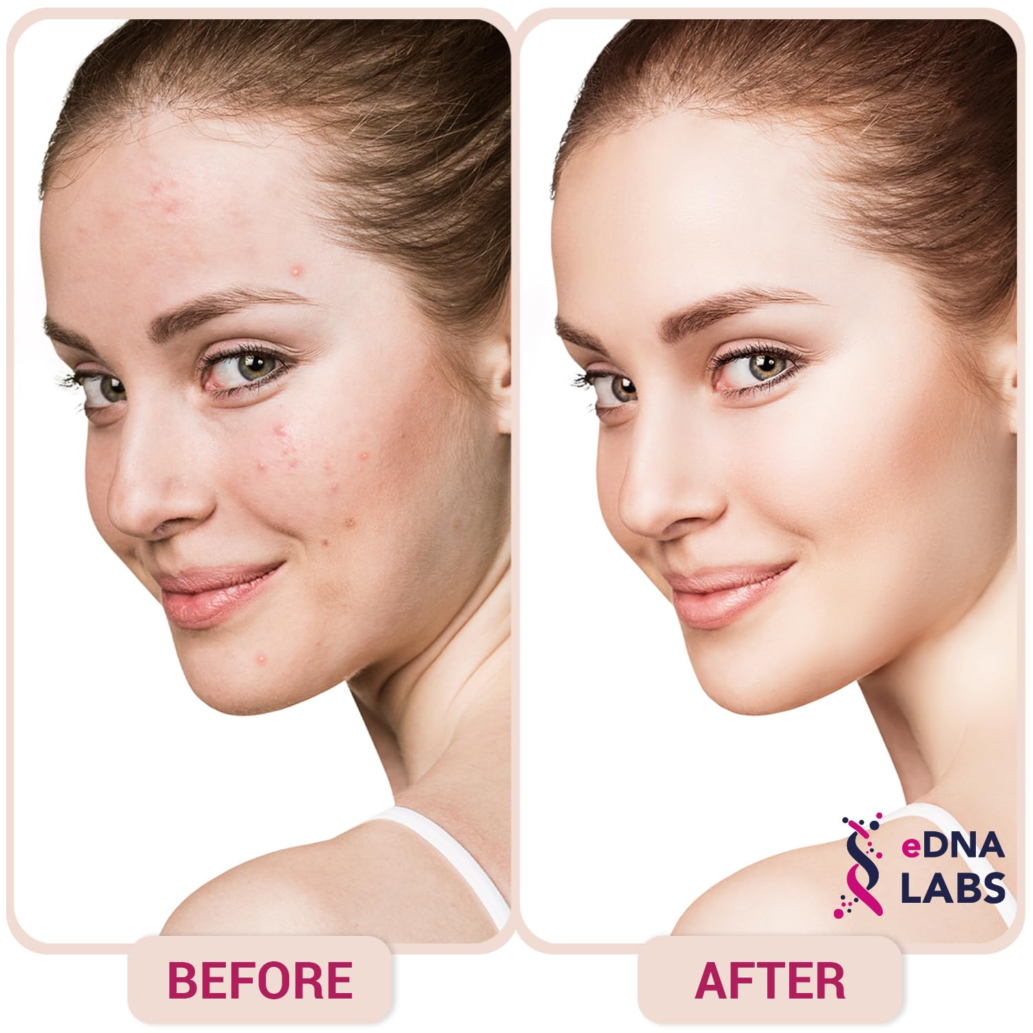 EDNA Labs Hypochlorous Acid Spray for Face & Skin | 8 oz, Facial Spray Daily Skin Solution, Made in USA