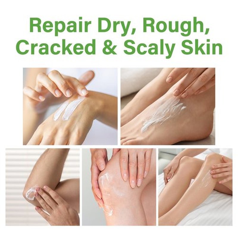 AOPEIBOTO Urea Cream 60 Percent for Feet Maximum Strength, Foot Cream for Dry Cracked Heels and Feet, Foot Moisturizer, 5.29oz/150g