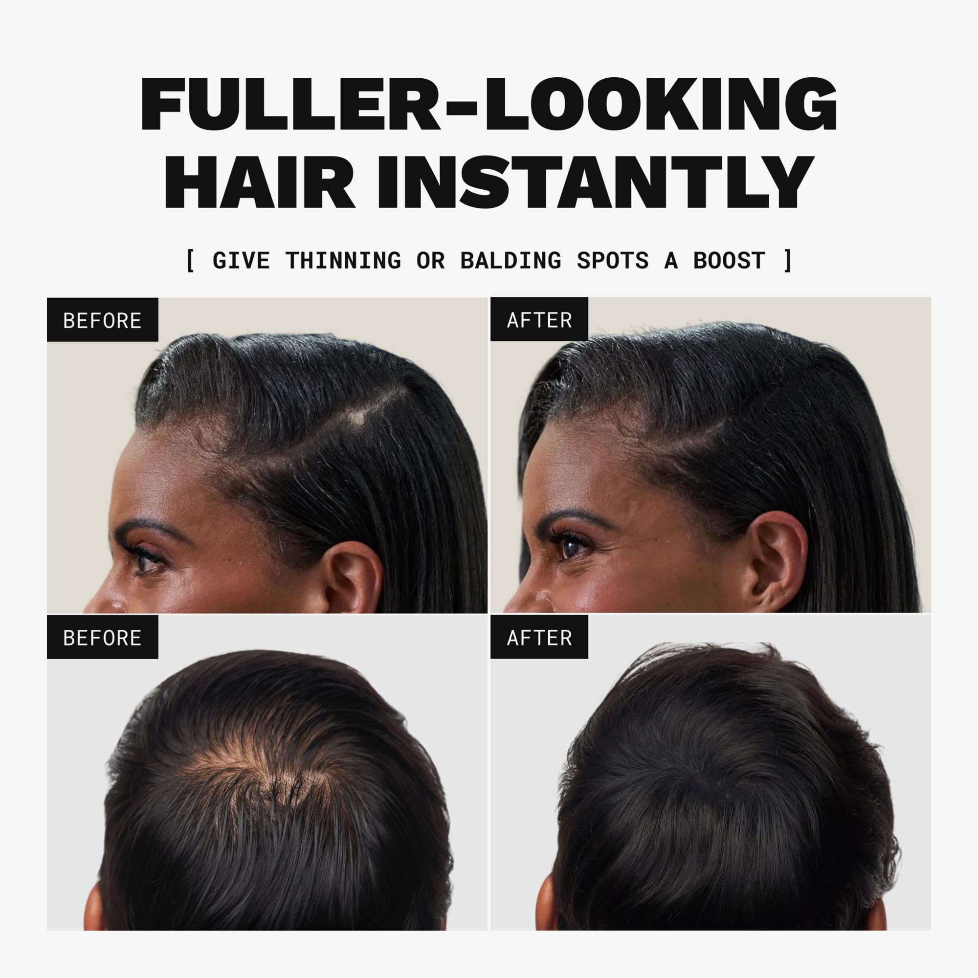 Toppik Hair Building Fibers, Medium Brown, 55g Fill In Fine or Thinning Hair, Instantly Thicker, Fuller Looking, 9 Shades for Men & Women, Keratin Protein Formula