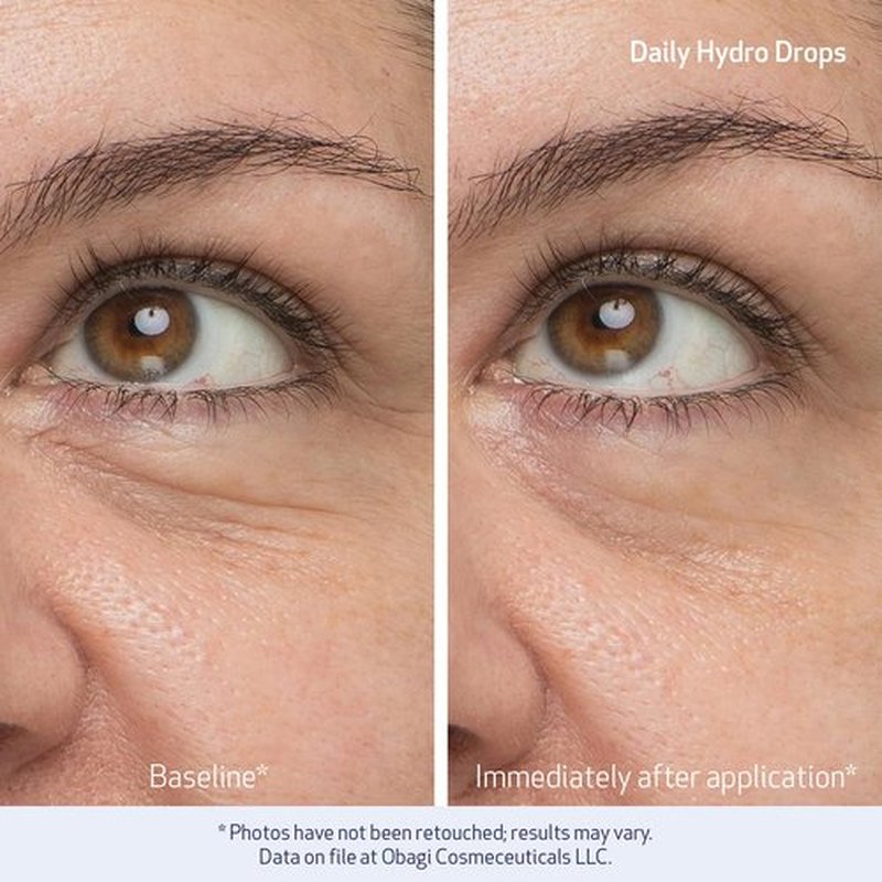 Obagi Daily Hydro-Drops Facial Serum & Eye Gel Cream Set - 1oz Serum Hydrates & 0.5oz Gel Brightens, Smooths, & Depuffs