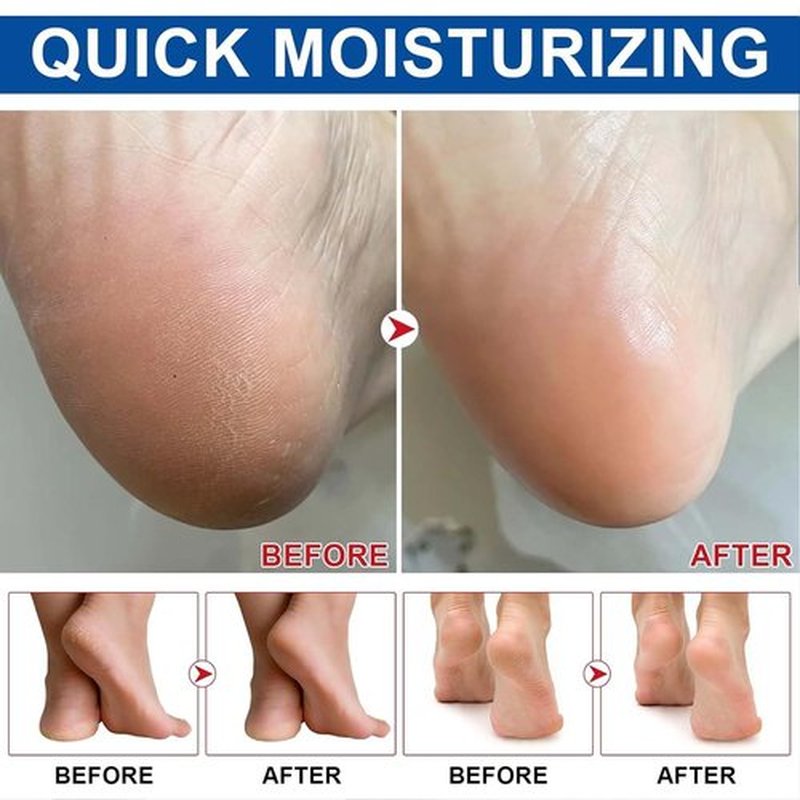 KTouler Roll On Urea Cream for Feet,Hydrating and Nourishing Foot Balm Stick,Foot Repair for Dry Skin and Rough Heels,Hands,Knees Skin Care Heel Treatment