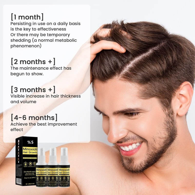 Xinweini Minoxidil for Men Beard Growth Kit, Minoxidil for Women Hair Growth Kit, Hair Loss Treatments for Women Hair Regrowth Treatment, Minoxidil 5%,3 pack