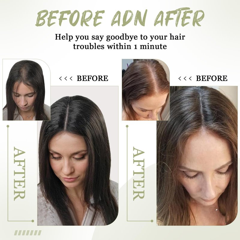 Urbeauty Hair Toppers for Women Real Human Hair for Thinning, 16 inch 1.5”x5”Silk Base Upgrade Topper, Clip-in Volume Enhancer, Natural-Looking, No Glue, Breathable, Lightweight