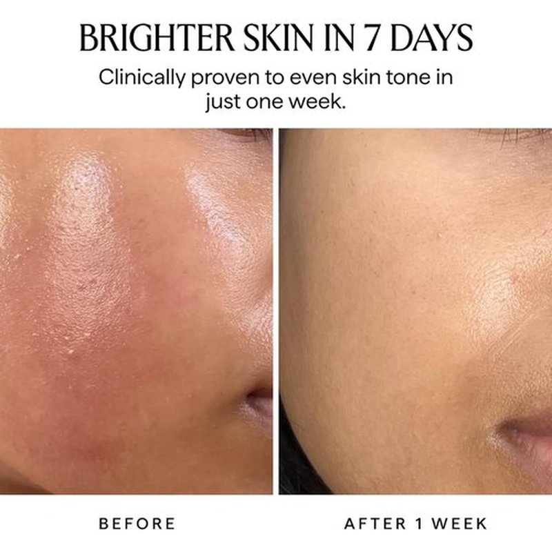 HERBIVORE Nova Brightening Serum - 15% Vitamin C & Turmeric for Dark Spots | Vegan, 30 mL / 1 oz