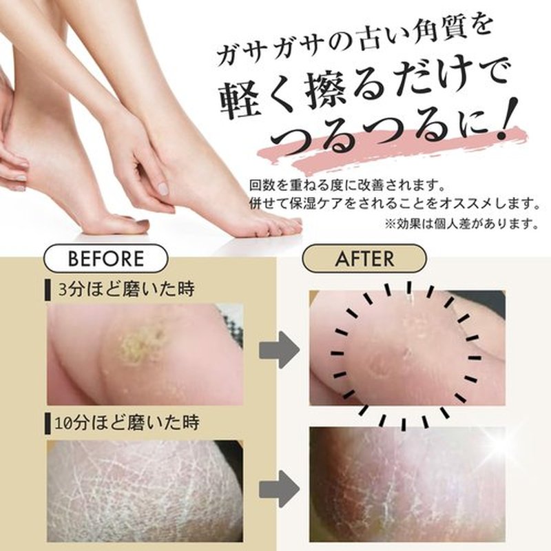 La SACHI heel exfoliating Glass made from nano technology soles exfoliating exfoliating heel care exfoliating foot care with strap
