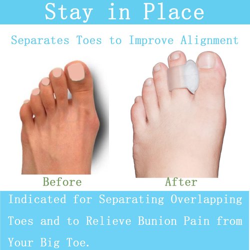 MENOCADY Pack of 12 Gel Toe Separator, (1/4" Thick) Big Toe Spacers, Single Loop Toe Spreader for Bunions, Overlapping Toe, Corrector and Spacer (Clear)