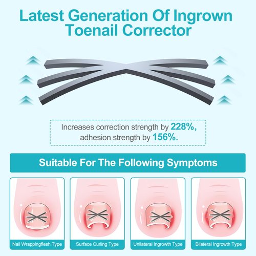 Ingrown Toenail Treatment Kit with Upgraded 6-Angle Shape,Titanium Alloy Ingrown Nail Corrector Tools with 4 Multi-Sizes,Ingrown Toe Nail Relief Remover Strips for Curved Toenail Quick Relief,8Pcs