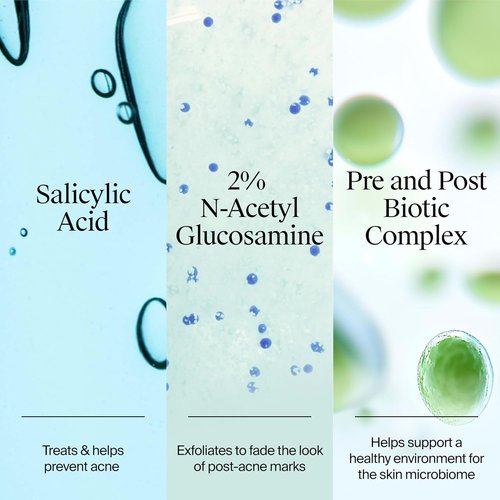 Neutrogena Evenly Clear Acne Gel Moisturizer - Lightweight Formula with Salicylic Acid & N-Acetyl Glucosamine | 1.7 fl. oz