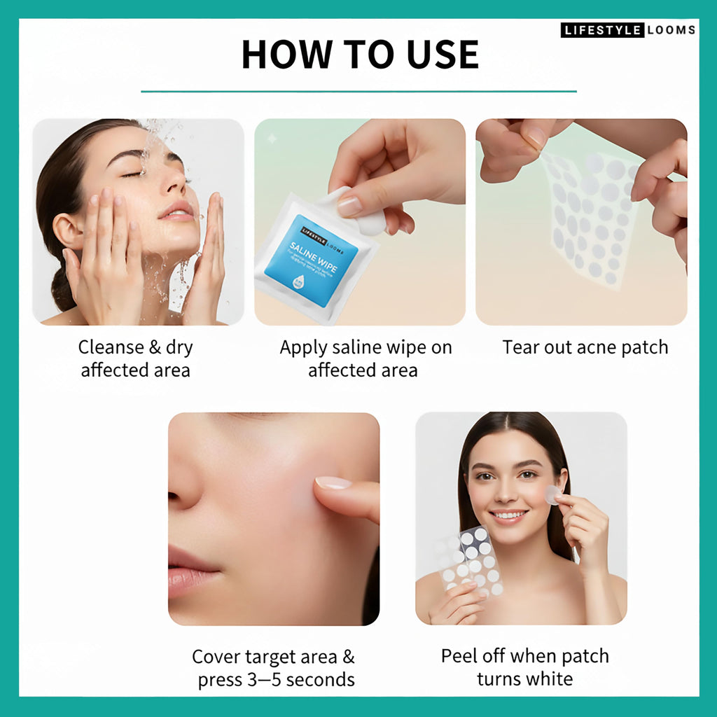 Salicylic Acid Acne Pimple Patches – Tea Tree Hydrocolloid Acne Patch, Invisible Spot Stickers for Face with Saline Wipe (36 Count)