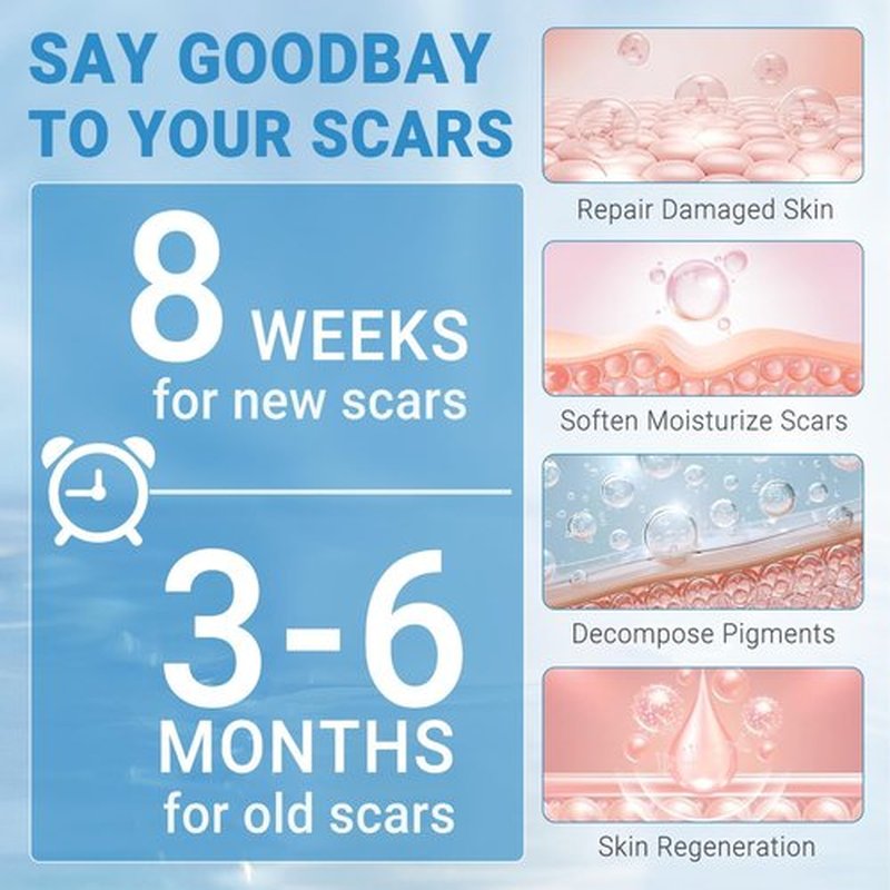 Kunyle Silicone Scar Gel, Scar Cream, Advanced Scar Stick for Surgical Scars, Stretch Marks, Keloid Bump Removal, Old and New Scars 0.63oz (18g)