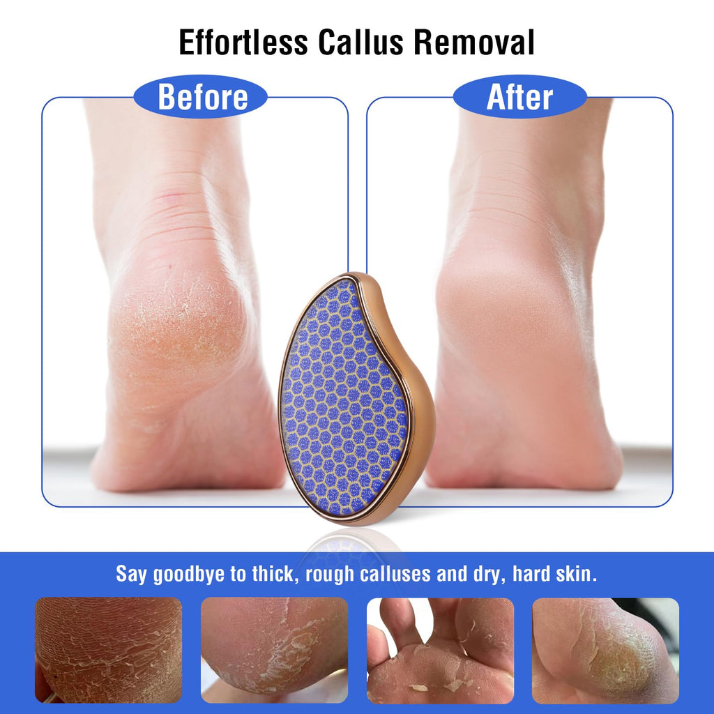 OUKEYA Glass Foot File Callus Remover: Nano Glass Heel Scraper for Feet Shower Foot Scrubber Pedicure Dead Skin Remover Shower Care Crystal Hair Remover Hair Eraser for Back Arms Legs 1PC