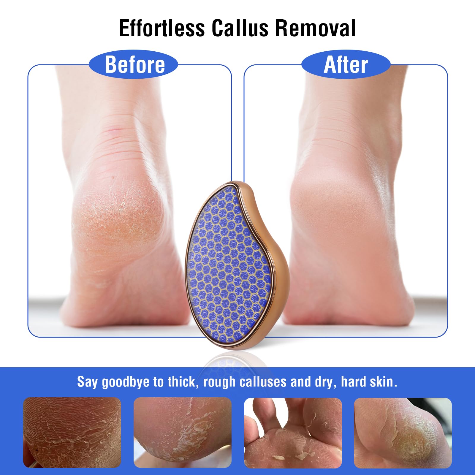 OUKEYA Glass Foot File Callus Remover: Nano Glass Heel Scraper for Feet Shower Foot Scrubber Pedicure Dead Skin Remover Shower Care Crystal Hair Remover Hair Eraser for Back Arms Legs 1PC