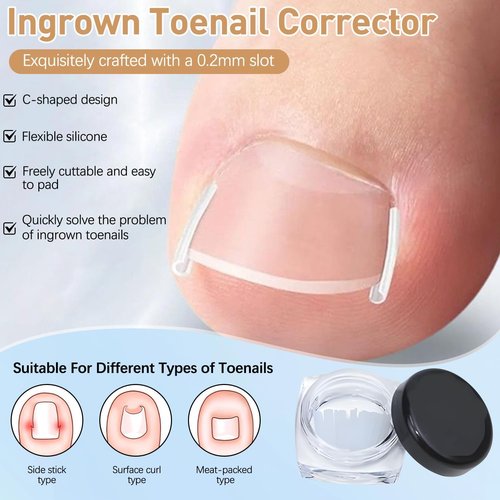 Ingrown Toenail Corrector Set with Correction Strips, Professional ingrown toenails pedicure tool set for men and women (1 SET)