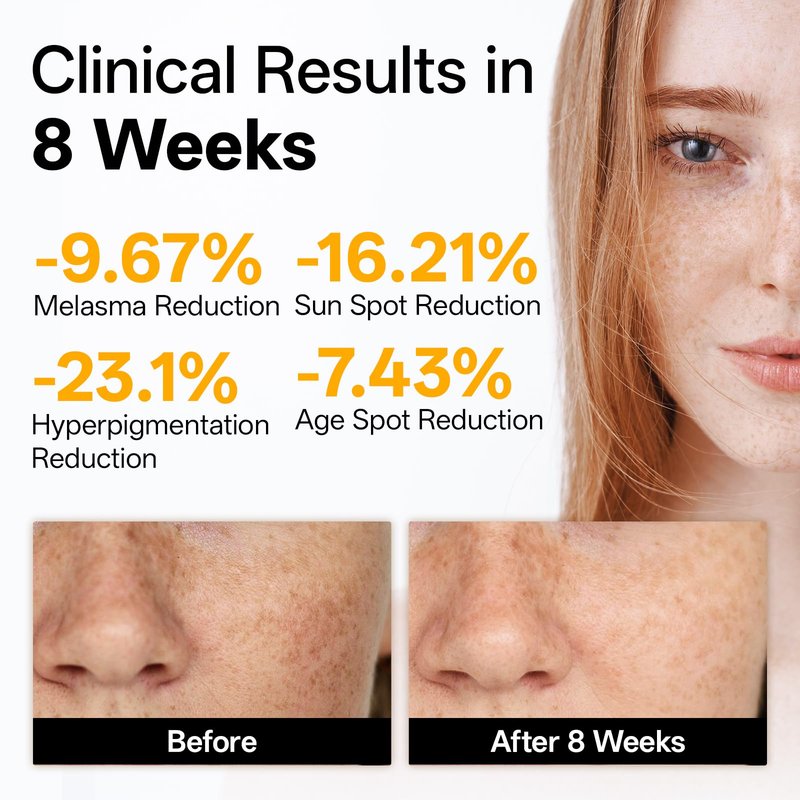 WNP Vitamin C Serum for Face - Dermatologist Tested Anti-Aging & Brightening with Hyaluronic Acid & Vitamin E, Treatment for Dark, Age, Sun Spot, Melasma, Hyperpigmentation, Fine Lines & Wrinkles