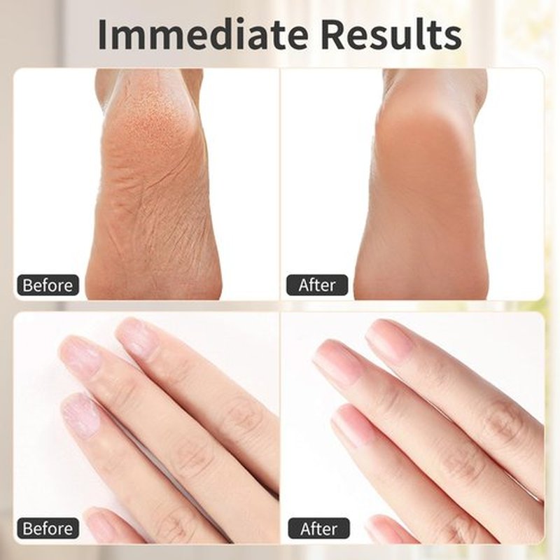 Electric Foot Callus Remover,FyndAna 2in 1 Rechargeable Foot File for Feet & Hand,6 Speeds with Sandpaper,Sanding Ring and Base,Wireless Foot Care Kit for Dead Skin and Calluses,Black
