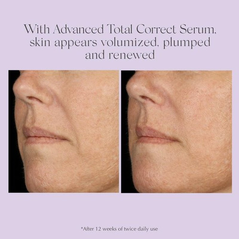 Exuviance Age Reverse+ Anti-Aging Skin Care Set | Mini Starter Kit for Wrinkles & Fine Lines - 4 Ct