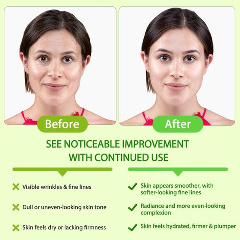 Moulis Green Coffee Bean Oil, Organic Green Coffee Oil for Cellulite, Skin, Face, Body & Hair - Reduces Puffiness, Dark Circles, Stretch Marks, Skin Tightening, Cold-Pressed (2 Fl Oz (Pack of 1))