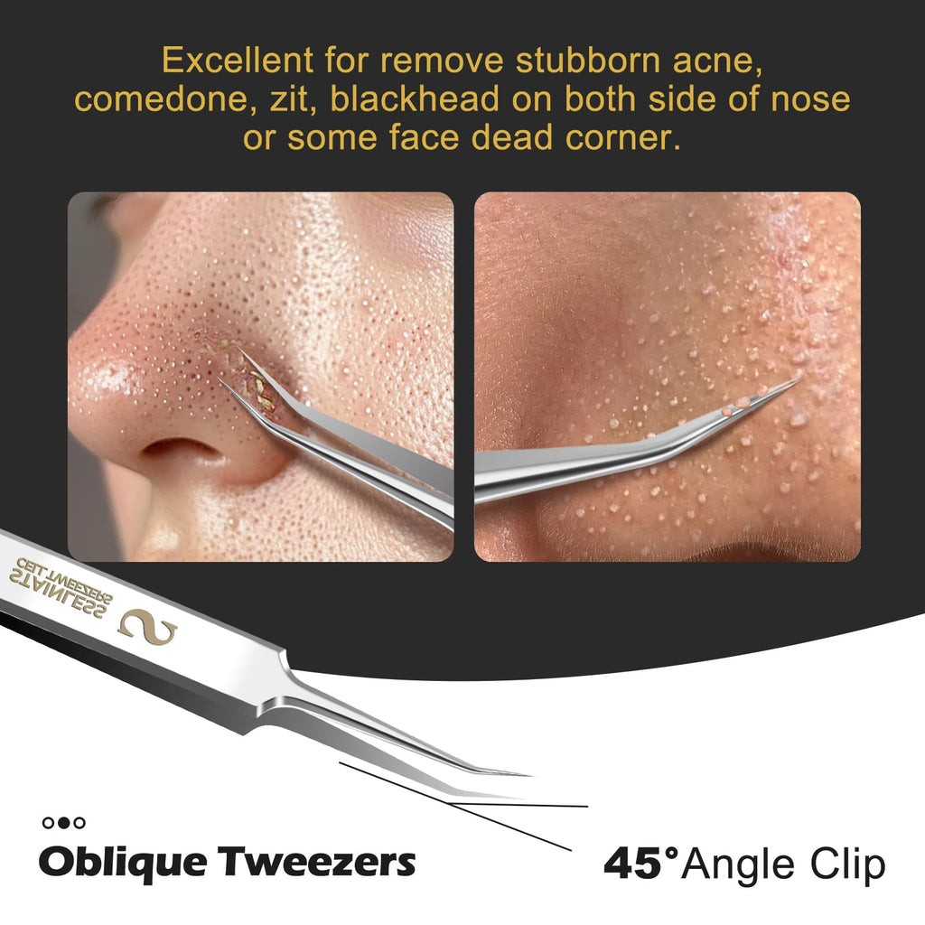 WSYUB Professional Blackhead Tweezers,Ingrown Hair Removal Kit