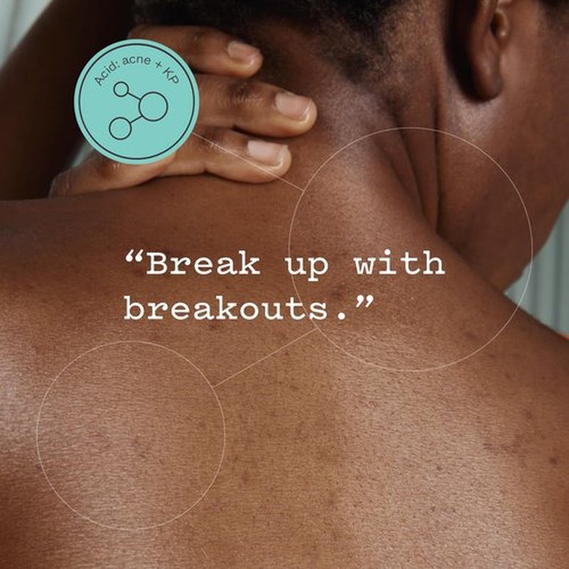 Frank Body Glycolic Acid Body Scrub - Fights KP, Breakouts & Tightens Pores | 8.82 oz