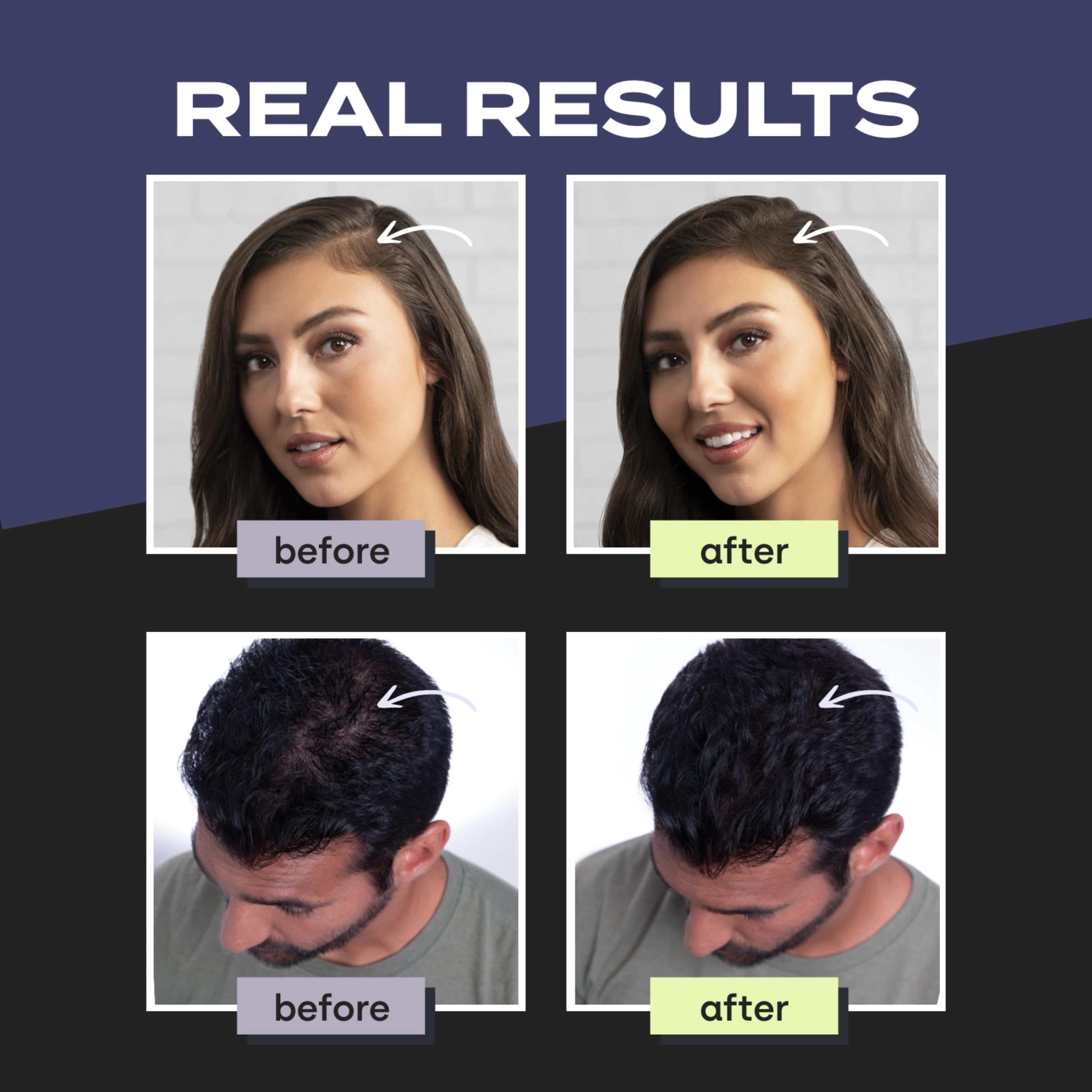 Toppik Hair Building Fibers, Light Blonde, 55g Fill In Fine or Thinning Hair, Instantly Thicker, Fuller Looking, 9 Shades for Men & Women, Keratin Protein Formula
