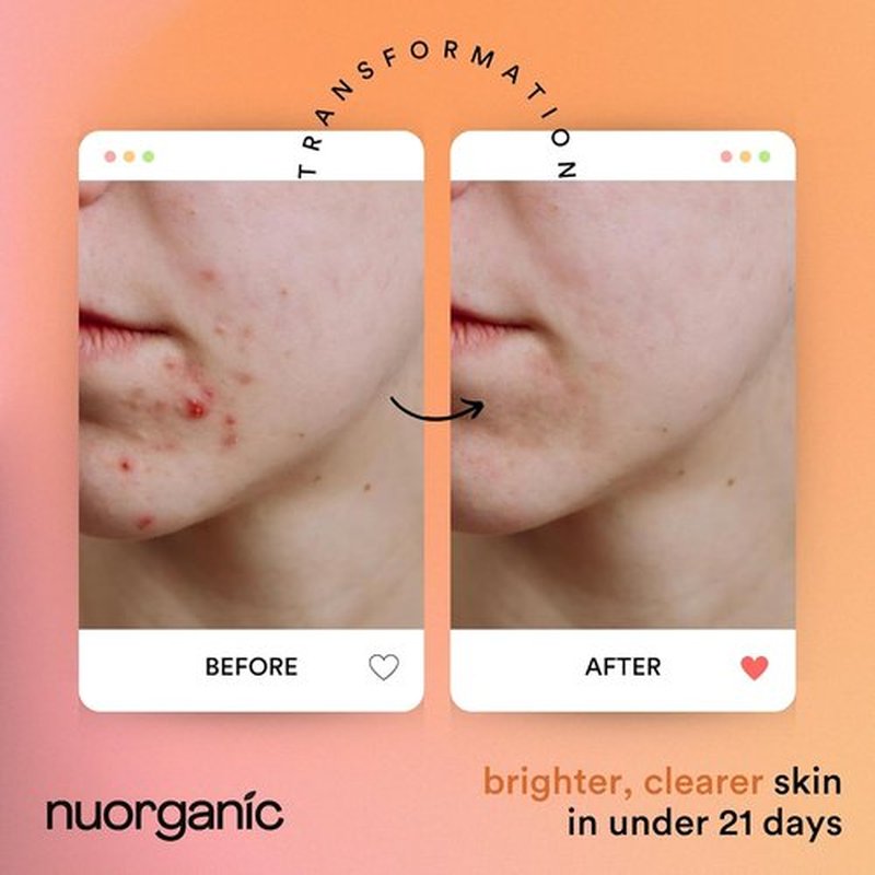 Nuorganic Turmeric Face Mask - Soothing & Acne Clearing - Airtight Squeezy Tube, 12-Month Freshness
