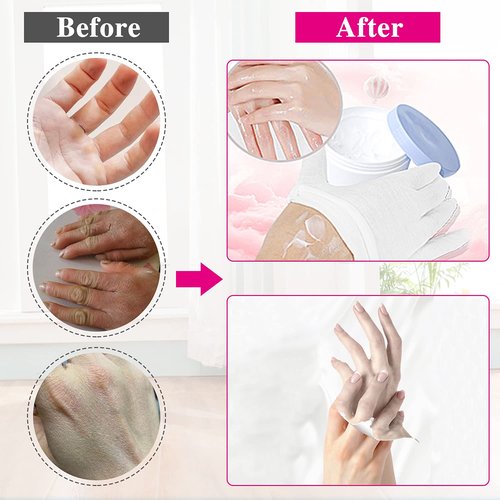 24Pcs White Cotton Gloves for Dry Hands Eczema Gloves Overnight Moisturizing Gloves for Women Cosmetic