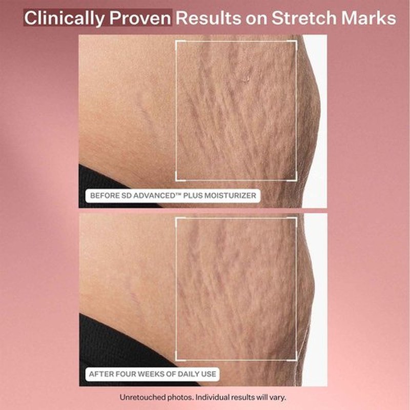 StriVectin Anti Wrinkle Trio Kit for Face and Eyes, 3 piece kit with SD Plus Moisturizer, Peptide Plump Line Face Serum, and Intensive Eye Concentrate Wrinkle Cream