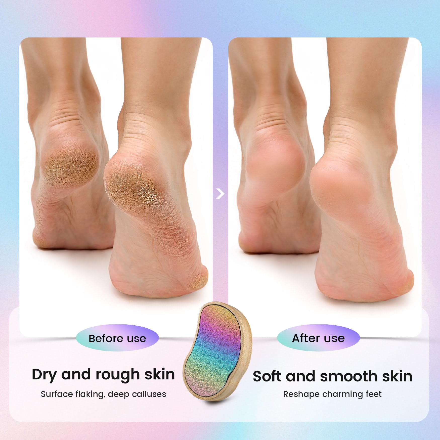 BEZOX Stainless Steel Pedi Egg Foot File Callus Remover for Dry and Wet Feet, Smooth Rough Skin, Plastic-Free Pedicure Tool Pumice Stone, Washable Foot Scrubber for Cracked Heels - Rainbow