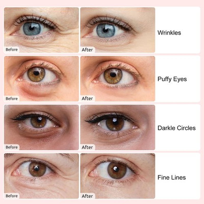 Adofect Under Eye Patches 40 Pairs, Collagen Eye Mask with Hyaluronic Acid for Dark Circles, Puffy Eyes, Under Eye Bags, Wrinkles, Skin Care for Valentine's Day, Bachelorette Party Favors, Spa Gifts