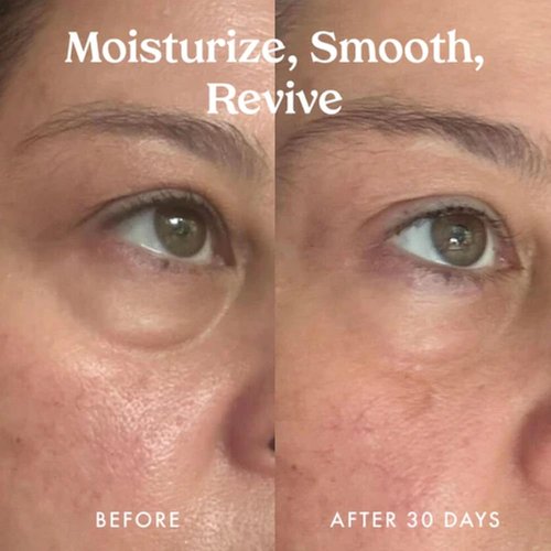 Kopari Ceramide & Retinol Eye Balm - Hydrating Anti-Aging Treatment for Fine Lines & Puffiness - Encapsulated Retinol & Ceramides