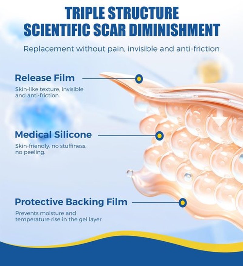 MasterMo Medical Grade Silicone Scar Sheets & Tape - 1.6”x120“ Roll, Ultra Soft, Hypoallergenic Rolls for Surgical, C-Section, Tummy Tuck, Keloid Scars, Stretch Marks & Burn Scar Removal