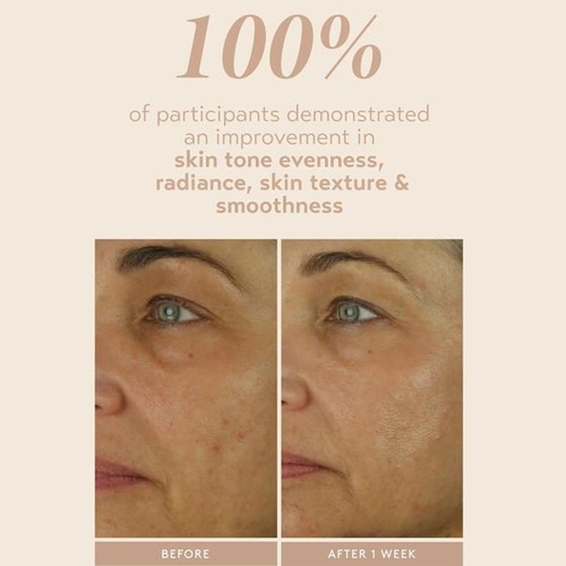 SHANI DARDEN SKIN CARE Retinol Reform Serum - 1% Encapsulated Retinol for Youthful Skin | 1 fl oz