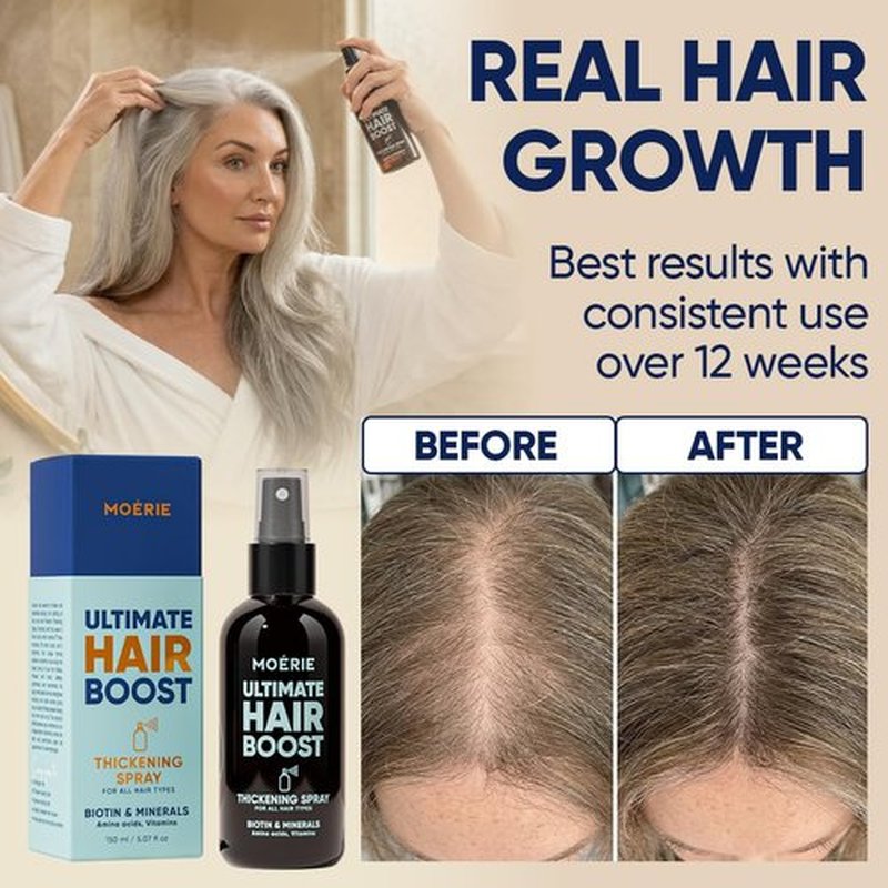 Moerie Hair Growth Serum Spray - Biotin & Rosemary Formula for Hair Regrowth | Unisex Thickening Solution