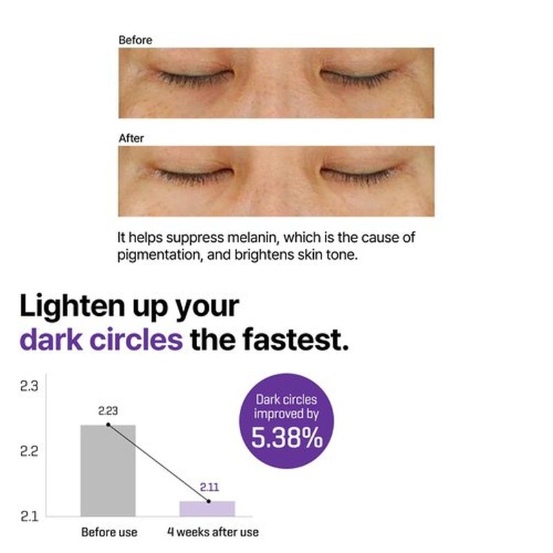 SOME BY MI Retinol Intense Advanced Triple Action Eye Cream – 1.01Oz, 30ml – Korean Retinol Under Eye Cream Anti Aging for Fine Lines – Brightens Dark Circles & Smooths Skin Texture – Korean Skin Care