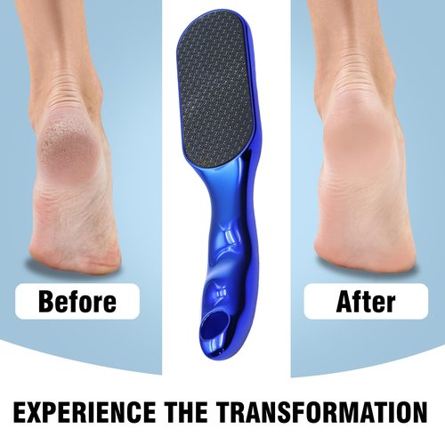 2 Pcs Veinsgrain Foot File, Nano Glass Foot File Hard Skin Remover with Non-Slip Ergonomic Handle, Professional Foot Care Tools for Smooth Feet(Gold+Blue)