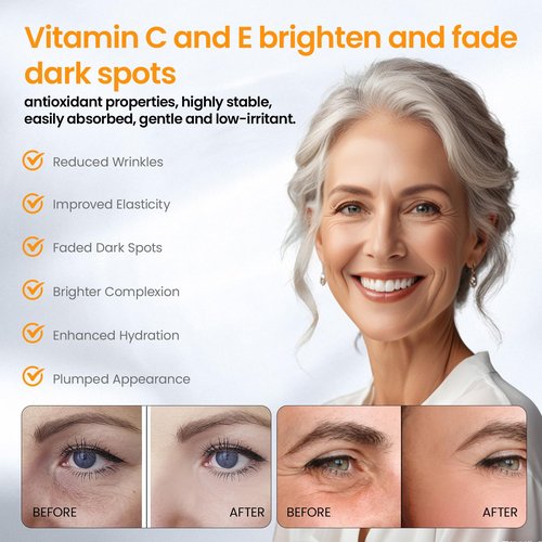 Super Vitamin C Serum for Face with Pure Hyaluronic Acid,Vitamin E,Tri-Peptide,B5, – Anti Aging, Dark Spot Remover & Collagen Booster – Hydrating, for Mature Skin – 1 fl oz