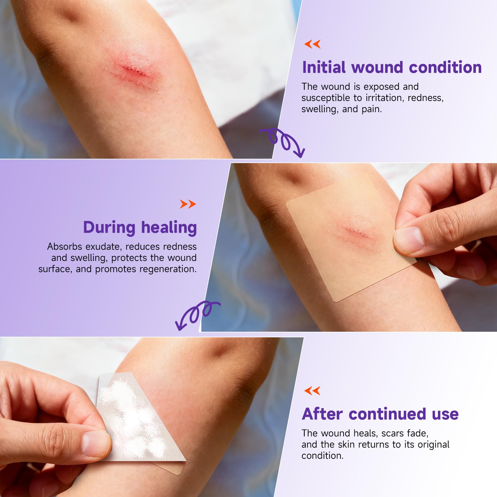 Hydrocolloid Roll for Wound Care, Hydrocolloid Bandages with Self-Adhesive, Flexible & Waterproof DIY Size & Shape (3.6)