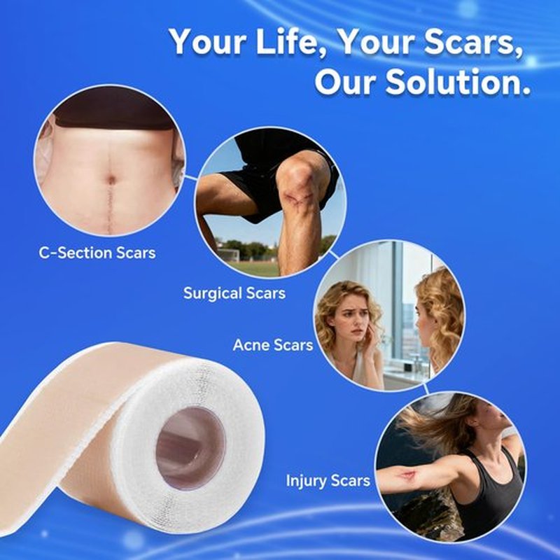 Professional Silicone Scar Sheets, Silicone Scar Tape, Silicone Scar Patch, Reusable Scar Silicone Strips (3M)