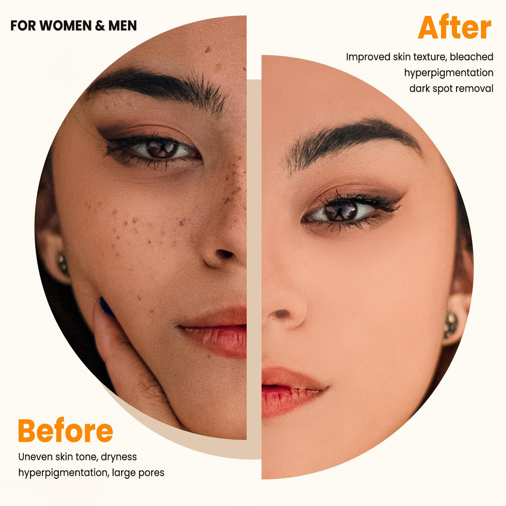 PIPIHUA Kojic Acid Soap - Turmeric Soap with Turmeric & Lemon & Collagen & Hyaluronic Acid & Glutathione