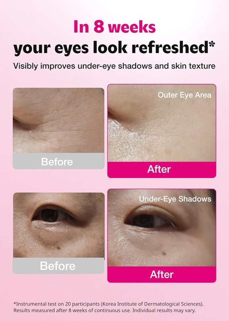 ISOI Blemish Care Under Eye Patches - Hydrating Gel Masks for Dark Circles & Puffiness | 90 Pcs, 3.17 Oz