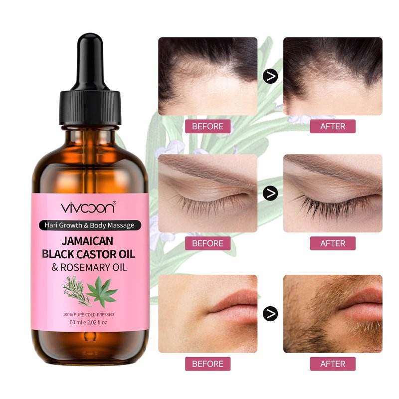 Vivccon Jamaican Organic Black Castor Oil with Rosemary, Cold Pressed,for Hair , Eyelashes and Eyebrows Growth,100% Natural & Pure