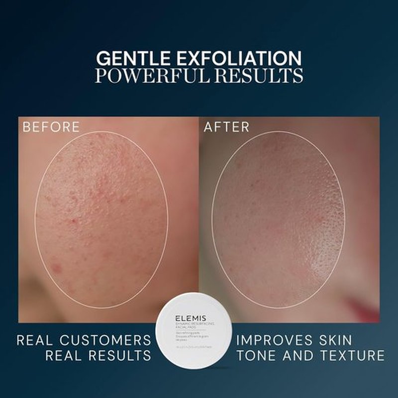 ELEMIS Dynamic Resurfacing Facial Pads - Gentle Exfoliating Treatment for Radiant Skin