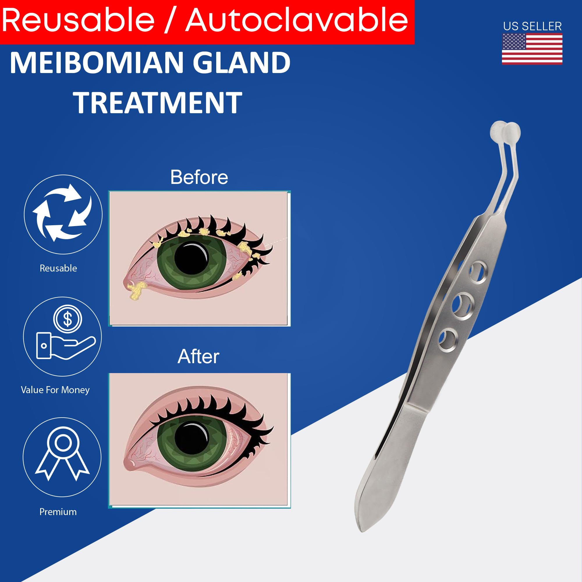 STELLMACHER Meibomian Gland Expressor Stainless Steel | Eyelid Massage Tweezers for Dry Eye Extraction | Chalazion Remover Eye Stye Treatment Cleaning Tool for Men & Women – 6mm Round Tip