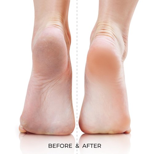 Kiss New York QuickBuff Foot File – Callus Remover for Feet, Spa Pedicure Quality, Dead Skin Removal, Emery Foot Heel Scrubber, Water and Rust Proof, Wet & Dry (Stainless Steel, Double-Sided)