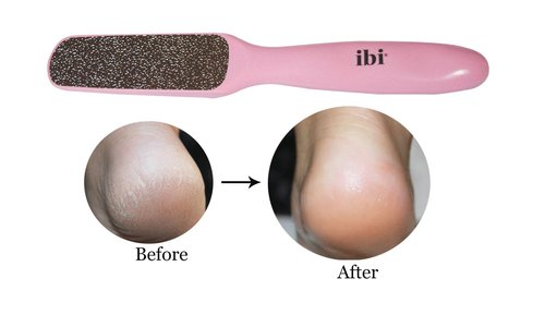 IBI 2-Sided Nickel Foot File Rasp for Callus Removal, Hypoallergenic, Plate Type