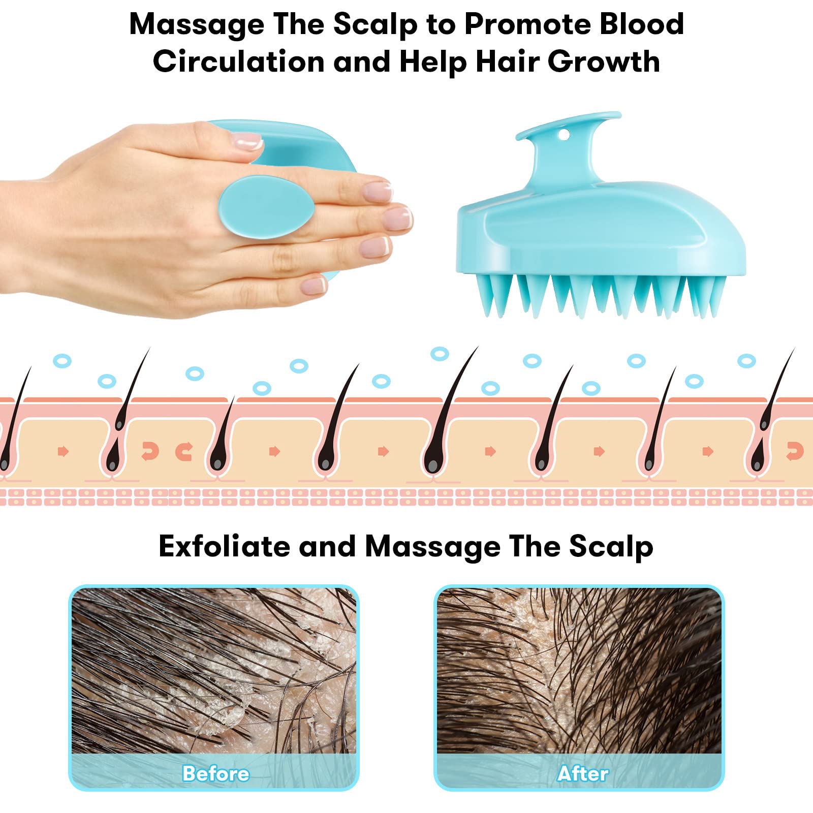 Sosoon Scalp Massager, Shampoo Brush Hair Scrub Brush for Wet and Dry Hair, Soft Silicone Bristles Head Massager Clean Hair, Reduce Dandruff, Massage Scalp, Promote Hair Growth, Blue