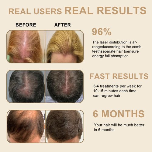 Laser Hair Growth Comb